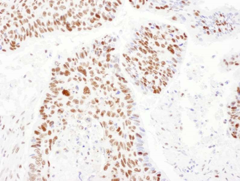 Immunohistochemistry (Formalin/PFA-fixed paraffin-embedded sections) - Anti-PSME3 antibody (AB157157)