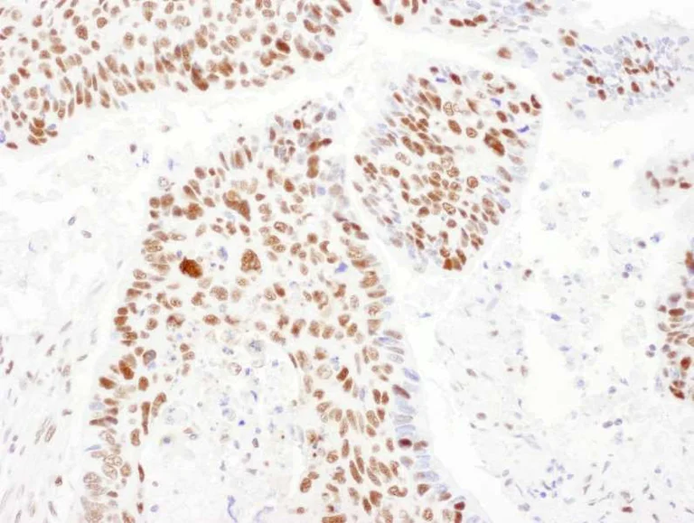 Immunohistochemistry (Formalin/PFA-fixed paraffin-embedded sections) - Anti-PSME3 antibody (AB157157)