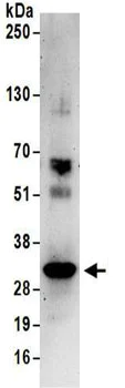 Immunoprecipitation - Anti-PSME3 antibody (AB157157)