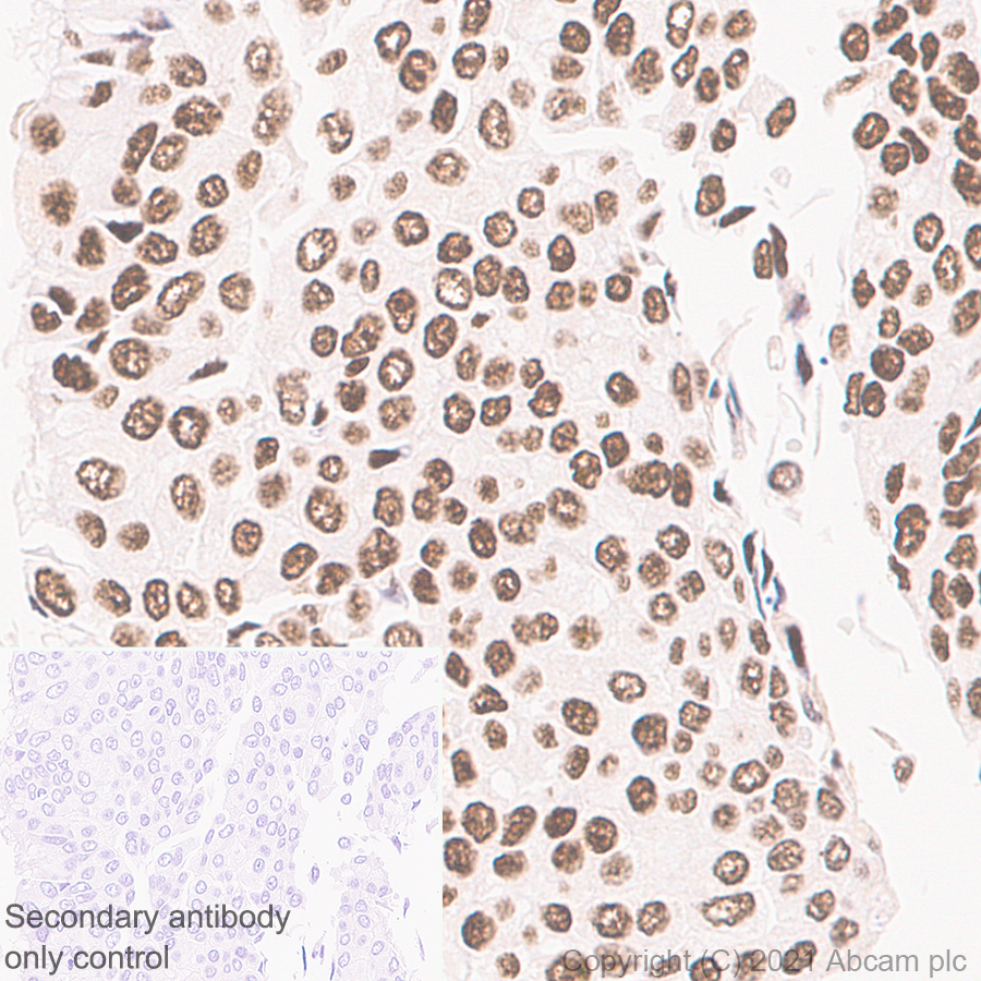 Immunohistochemistry (Formalin/PFA-fixed paraffin-embedded sections) - Anti-PSME3 antibody [EPR24504-11] (AB282576), expandable thumbnail