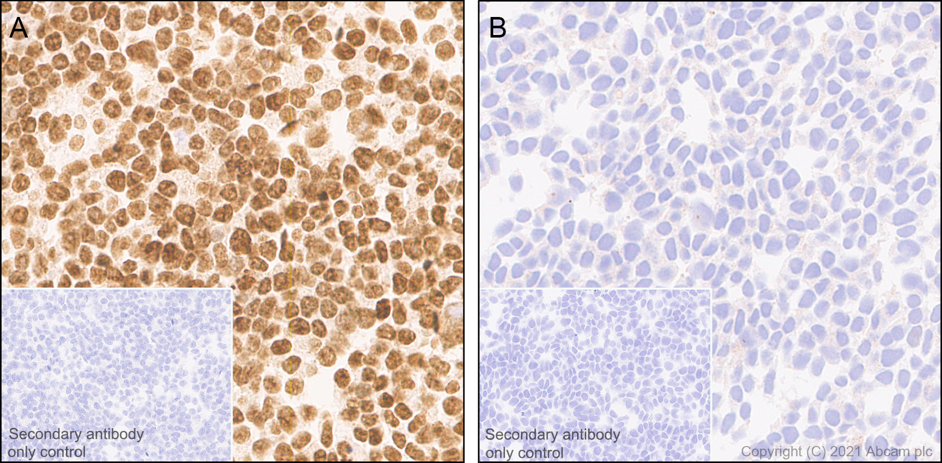 Immunohistochemistry (Formalin/PFA-fixed paraffin-embedded sections) - Anti-PSME3 antibody [EPR24504-11] (AB282576), expandable thumbnail