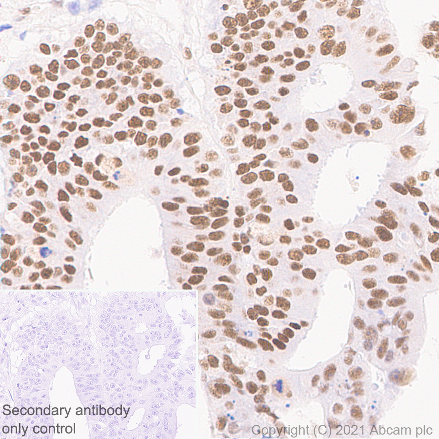 Immunohistochemistry (Formalin/PFA-fixed paraffin-embedded sections) - Anti-PSME3 antibody [EPR24504-11] (AB282576), expandable thumbnail
