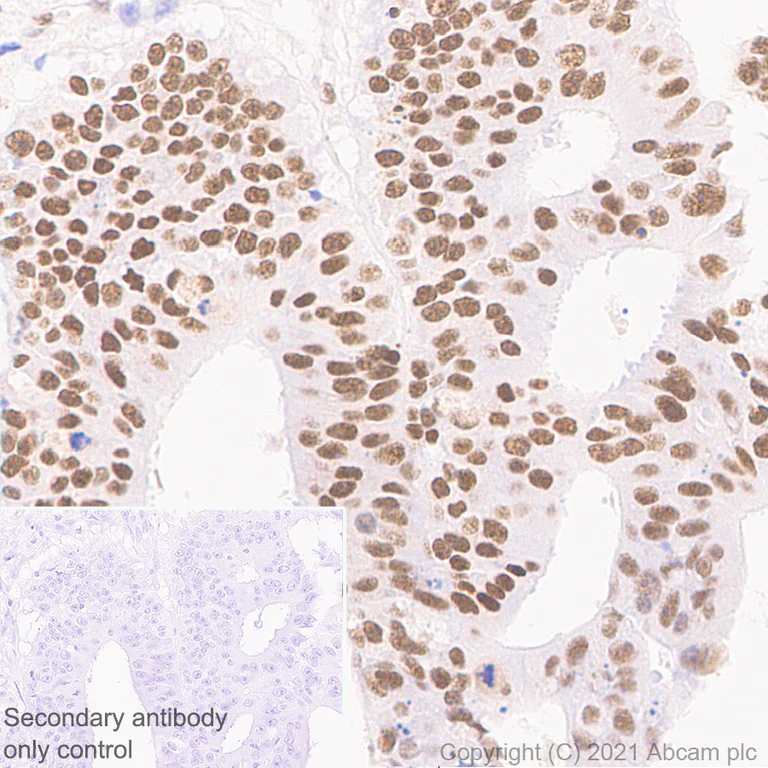 Immunohistochemistry (Formalin/PFA-fixed paraffin-embedded sections) - Anti-PSME3 antibody [EPR24504-11] - BSA and Azide free (AB282600)