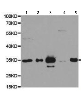 Western blot - Anti-PSMF1 antibody (AB187200), expandable thumbnail