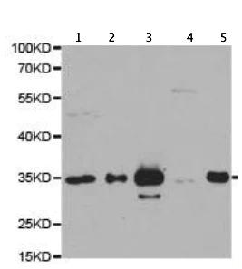 Western blot - Anti-PSMF1 antibody (AB187200)