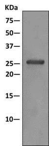 Immunoprecipitation - Anti-PSMG1 antibody [EPR10223] - BSA and Azide free (AB249415)