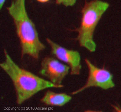 Immunocytochemistry/ Immunofluorescence - Anti-Psoriasin antibody [47C1068] (AB13680)