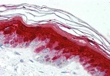 Immunohistochemistry (Formalin/PFA-fixed paraffin-embedded sections) - Anti-Psoriasin antibody [47C1068] (AB13680)