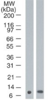 Anti-Psoriasin antibody [47C1068]