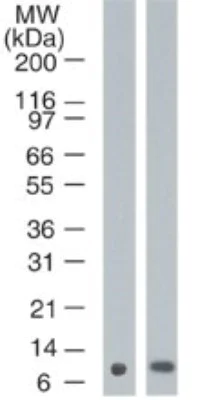 Western blot - Anti-Psoriasin antibody [47C1068] (AB13680)