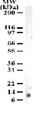 Western blot - Anti-Psoriasin antibody [47C1068] (AB13680)