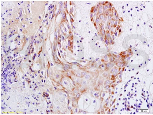 Immunohistochemistry (Formalin/PFA-fixed paraffin-embedded sections) - Anti-Psoriasin antibody (AB218207)
