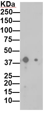 Western blot - Anti-Psoriasin antibody [EPR10433(2)] (AB172966)