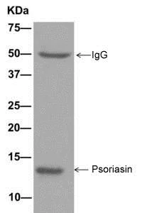 Immunoprecipitation - Anti-Psoriasin antibody [EPR10433(2)] - BSA and Azide free (AB249738)