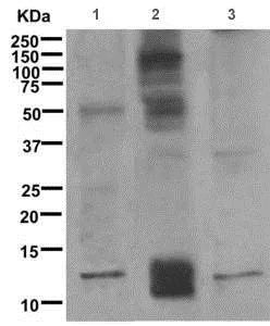 Western blot - Anti-Psoriasin antibody [EPR10433(2)] - BSA and Azide free (AB249738)