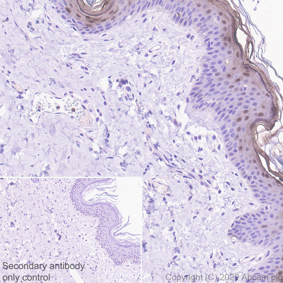 Immunohistochemistry (Formalin/PFA-fixed paraffin-embedded sections) - Anti-Psoriasin antibody [EPR23482-38] - BSA and Azide free (AB275040), expandable thumbnail
