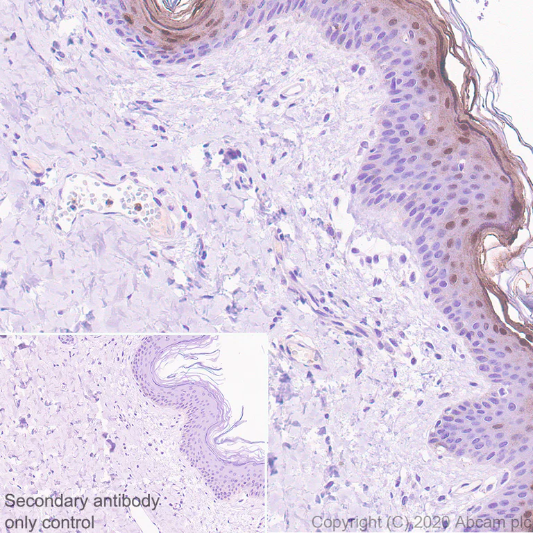 Immunohistochemistry (Formalin/PFA-fixed paraffin-embedded sections) - Anti-Psoriasin antibody [EPR23482-38] - BSA and Azide free (AB275040)