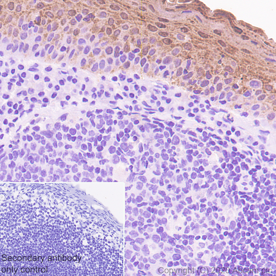 Immunohistochemistry (Formalin/PFA-fixed paraffin-embedded sections) - Anti-Psoriasin antibody [EPR23482-38] - BSA and Azide free (ab275040), expandable thumbnail