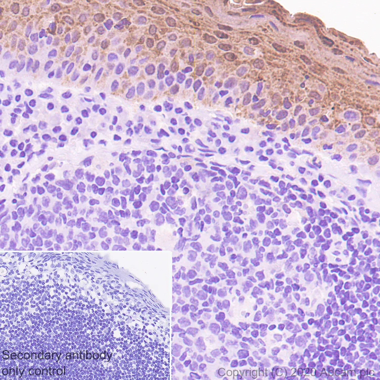 Immunohistochemistry (Formalin/PFA-fixed paraffin-embedded sections) - Anti-Psoriasin antibody [EPR23482-38] - BSA and Azide free (AB275040)