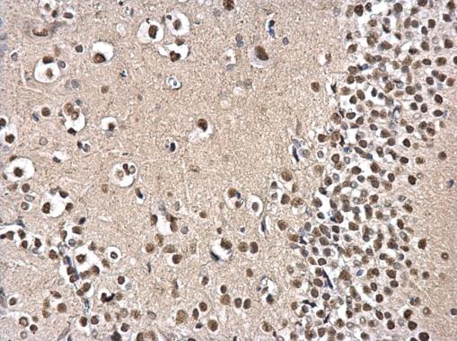 Immunohistochemistry (Formalin/PFA-fixed paraffin-embedded sections) - Anti-PSPC1 antibody (AB184123), expandable thumbnail