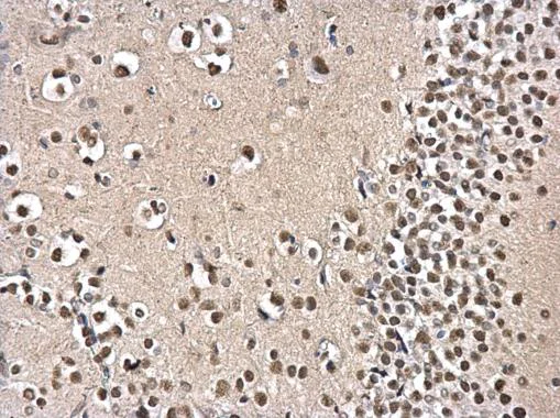 Immunohistochemistry (Formalin/PFA-fixed paraffin-embedded sections) - Anti-PSPC1 antibody (AB184123)