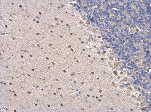 Immunohistochemistry (Formalin/PFA-fixed paraffin-embedded sections) - Anti-PSPC1 antibody (AB184123), expandable thumbnail