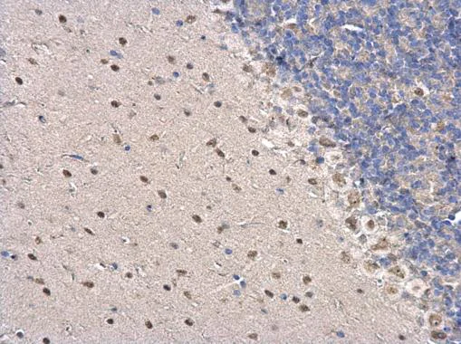 Immunohistochemistry (Formalin/PFA-fixed paraffin-embedded sections) - Anti-PSPC1 antibody (AB184123)