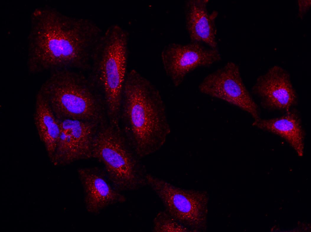Immunocytochemistry - Anti-PSPH antibody [001] - BSA and Azide free (AB276045), expandable thumbnail