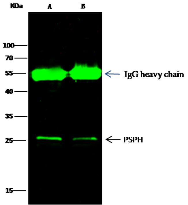 Immunoprecipitation - Anti-PSPH antibody [001] - BSA and Azide free (AB276045), expandable thumbnail