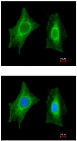 Immunocytochemistry/ Immunofluorescence - Anti-PSPH antibody (AB211418)