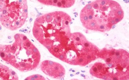 Immunohistochemistry (Formalin/PFA-fixed paraffin-embedded sections) - Anti-PSPH antibody (AB211418)