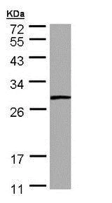 Western blot - Anti-PSPH antibody (AB211418)