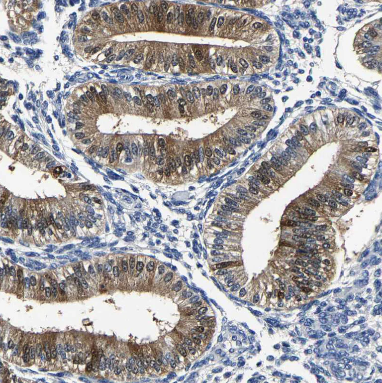 Immunohistochemistry (Formalin/PFA-fixed paraffin-embedded sections) - Anti-PSPH antibody (AB224110)