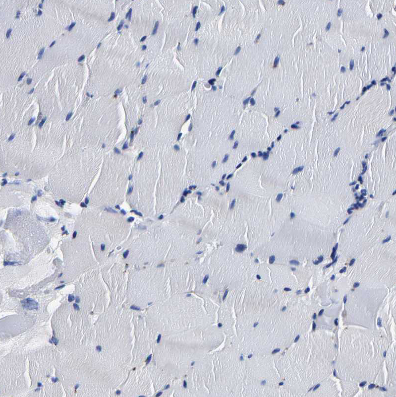 Immunohistochemistry (Formalin/PFA-fixed paraffin-embedded sections) - Anti-PSPH antibody (AB224110)