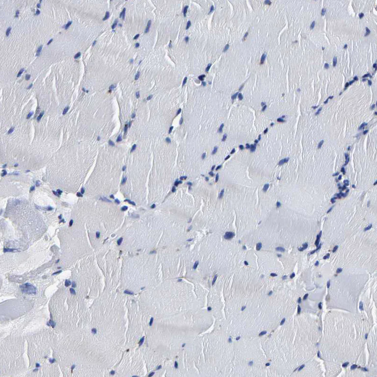 Immunohistochemistry (Formalin/PFA-fixed paraffin-embedded sections) - Anti-PSPH antibody (AB224110)