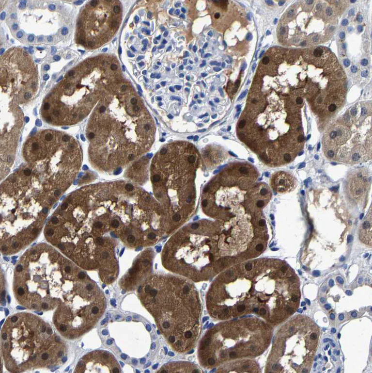 Immunohistochemistry (Formalin/PFA-fixed paraffin-embedded sections) - Anti-PSPH antibody (AB224110)