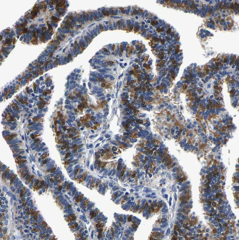 Immunohistochemistry (Formalin/PFA-fixed paraffin-embedded sections) - Anti-PSPH antibody (AB224110)