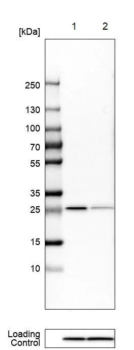 Western blot - Anti-PSPH antibody (AB224110)