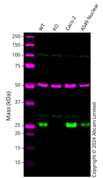 Western blot - Anti-PSPH antibody (AB224110)