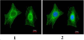 Immunocytochemistry/ Immunofluorescence - Anti-PSPH antibody (AB96414)