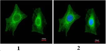 Immunocytochemistry/ Immunofluorescence - Anti-PSPH antibody (AB96414)