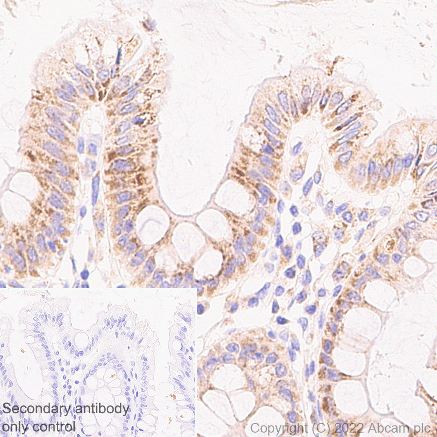 Immunohistochemistry - Anti-PSPH antibody [EPR26995-88A] (ab306577), expandable thumbnail