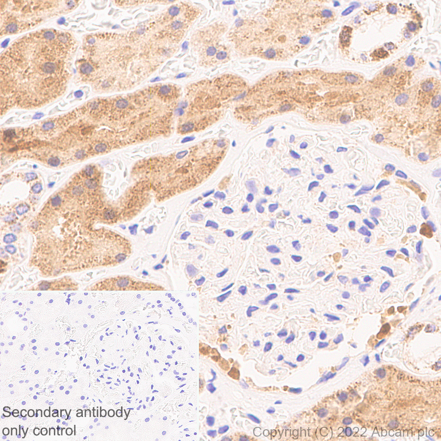 Immunohistochemistry - Anti-PSPH antibody [EPR26995-88A] (AB306577), expandable thumbnail