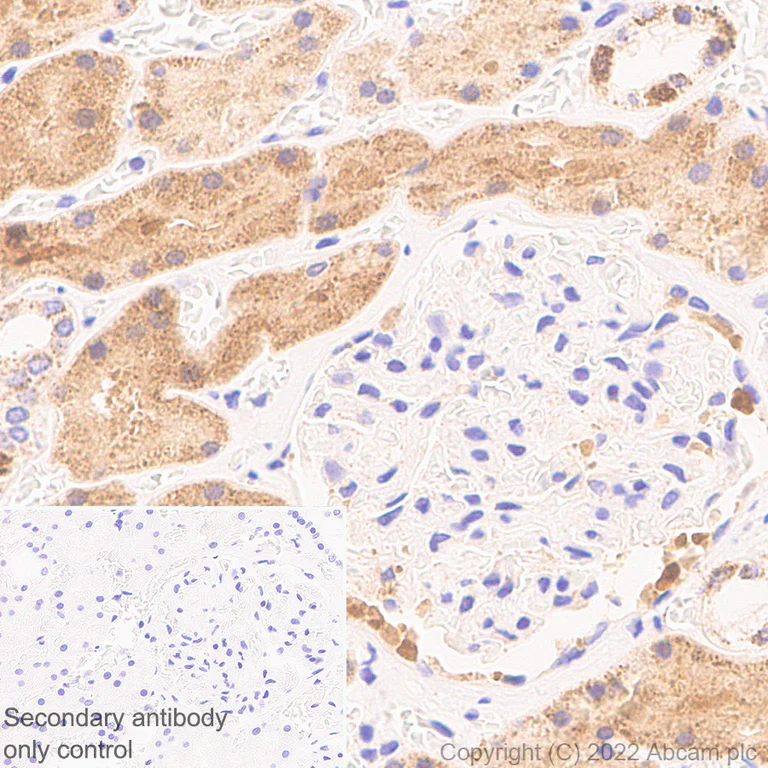 Immunohistochemistry - Anti-PSPH antibody [EPR26995-88A] (AB306577)