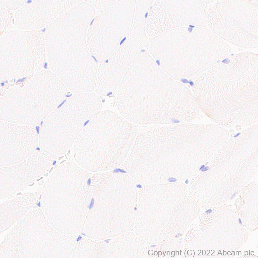 Immunohistochemistry - Anti-PSPH antibody [EPR26995-88A] (AB306577), expandable thumbnail
