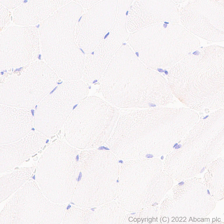 Immunohistochemistry - Anti-PSPH antibody [EPR26995-88A] (AB306577)