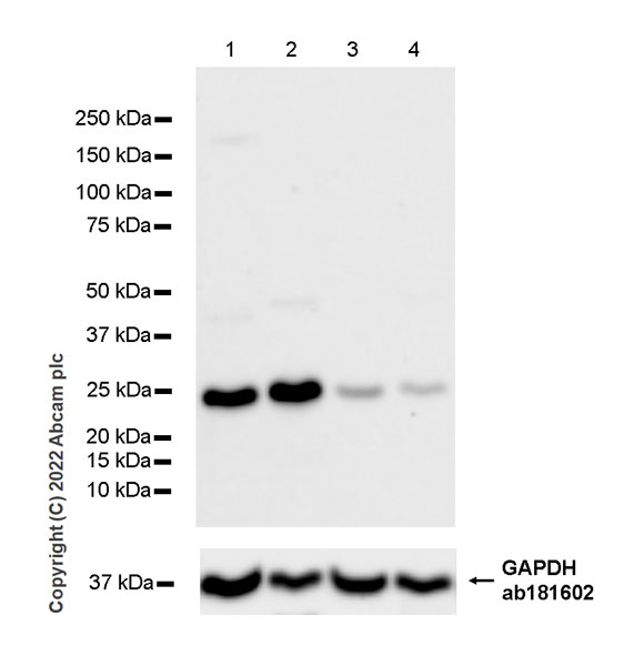 Western blot - Anti-PSPH antibody [EPR26995-88A] (AB306577), expandable thumbnail