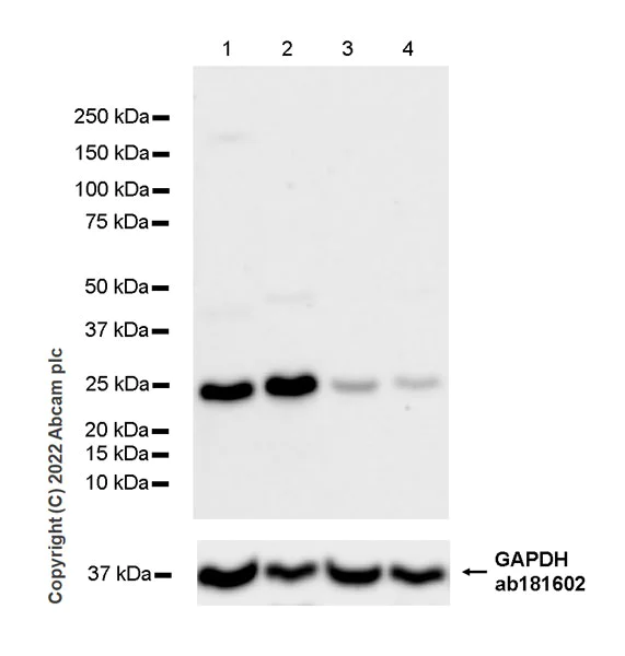 Western blot - Anti-PSPH antibody [EPR26995-88A] (AB306577)