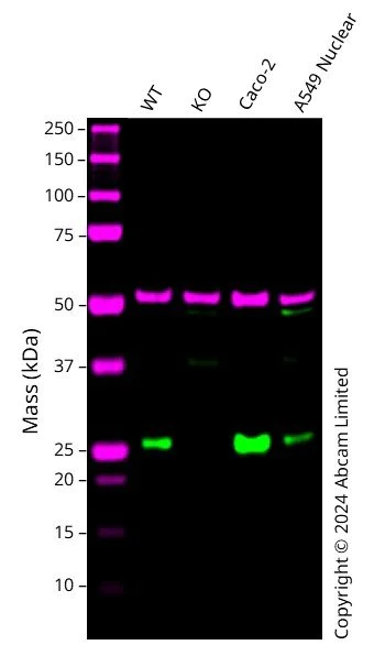 Western blot - Anti-PSPH antibody [EPR26995-88A] (AB306577)