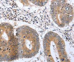 Immunohistochemistry (Formalin/PFA-fixed paraffin-embedded sections) - Anti-PSPN antibody (AB198256)